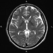 томография головного мозга в севастополе